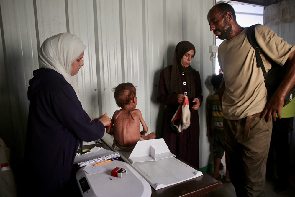 A malnourished Palestinian child gets a check up at a medical point run by a local NGO affiliated with the primary health care of the Palestinian health ministry in al-Mawasi, in the southern Gaza Strip district of Khan Yunis, on August 13, 2025. (AFP)