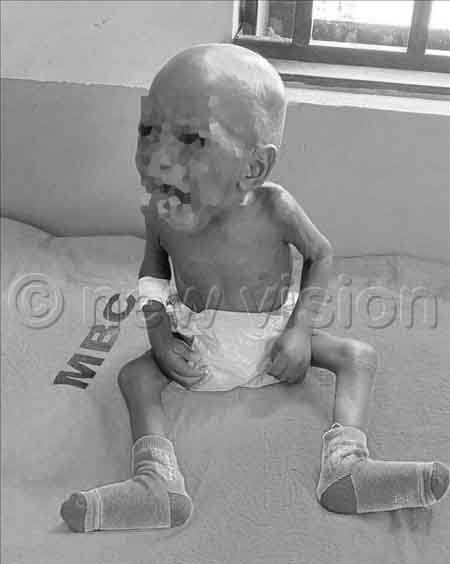 Baby Rahim Ssegirinya when it had just been admitted at Project Orphans Medical Centre in Luwero.