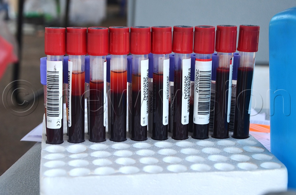 Some of the collected units of blood at Soroti Fruit Factory on Saturday. Credit: Delux Emmy Alomu)