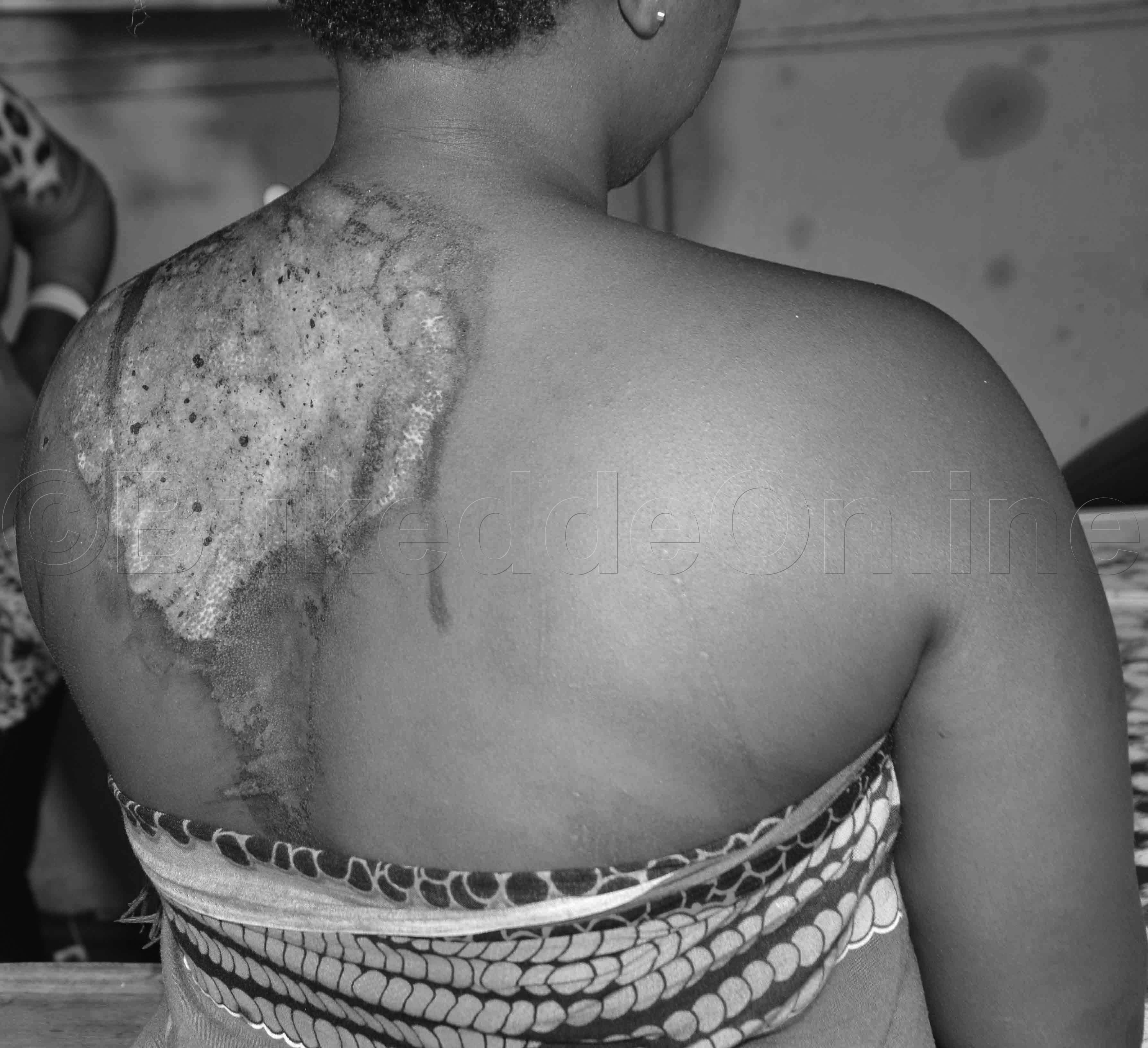 Kannyana Bw'afaanan Mu Mugongo.