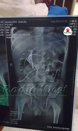 Samuel Akamumpa,9, ou bashemiize bakihamu empitirizo 46 ezi muk'ishe arikugambwa kuba abaire yahisya arikumumurisa.