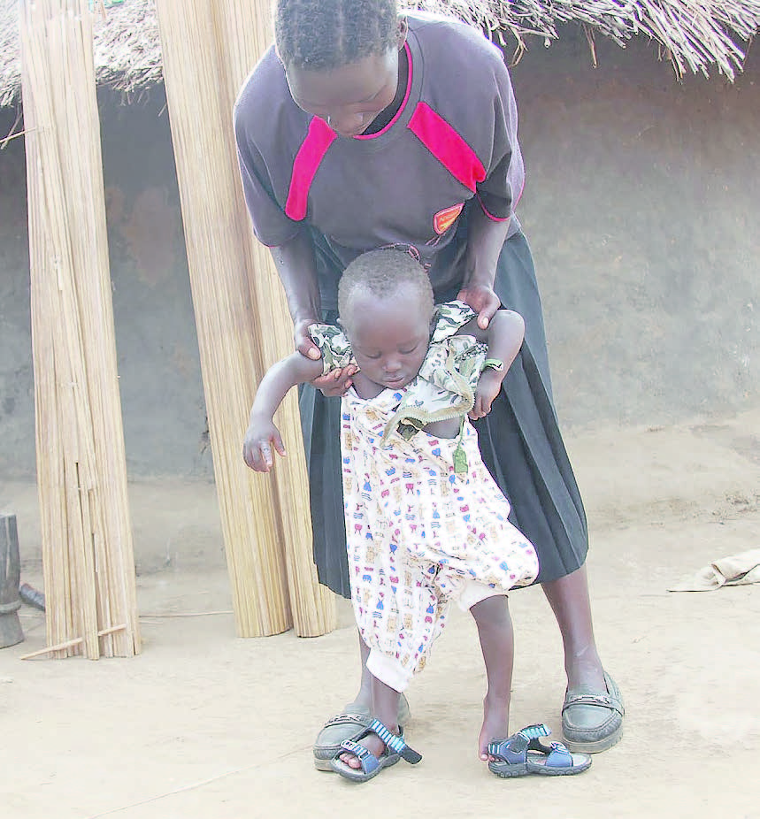 Lucy Lanyero ow’e Amuru ng’ayamba omwana we Bosco Opoka eyagongobala amagulu olwa polio.