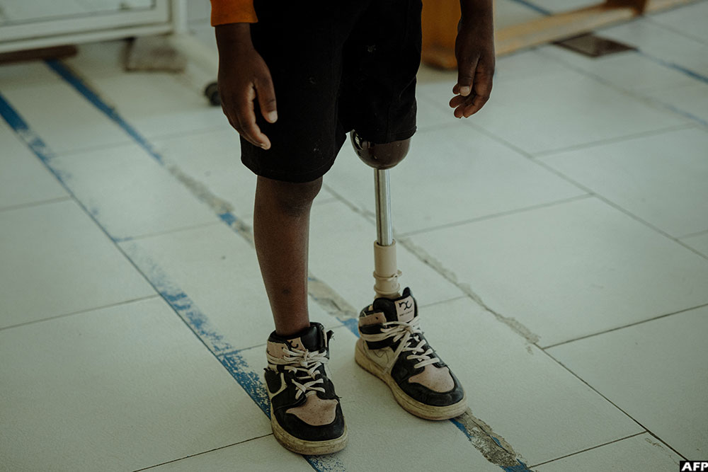 Patrick Ndagije, 13, from Bishushe in Rutshuru territory, was injured by a bullet in 2024