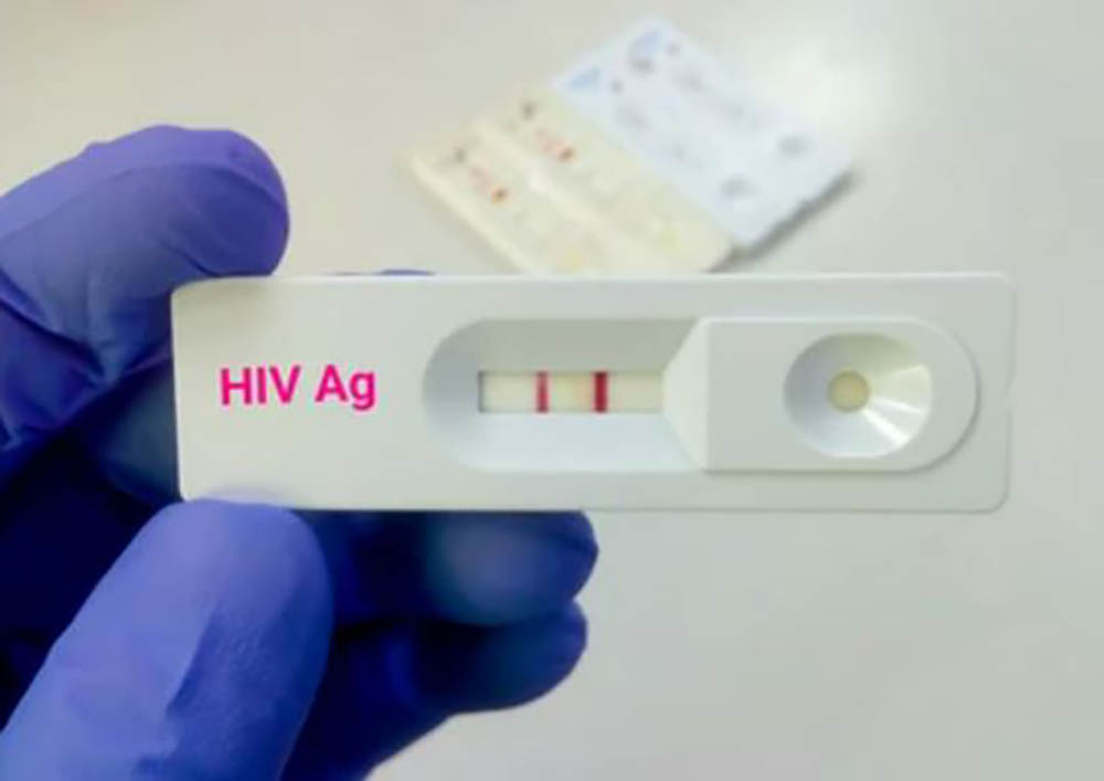 Govt to give out free HIV testing kits Bukedde Online Amawulire