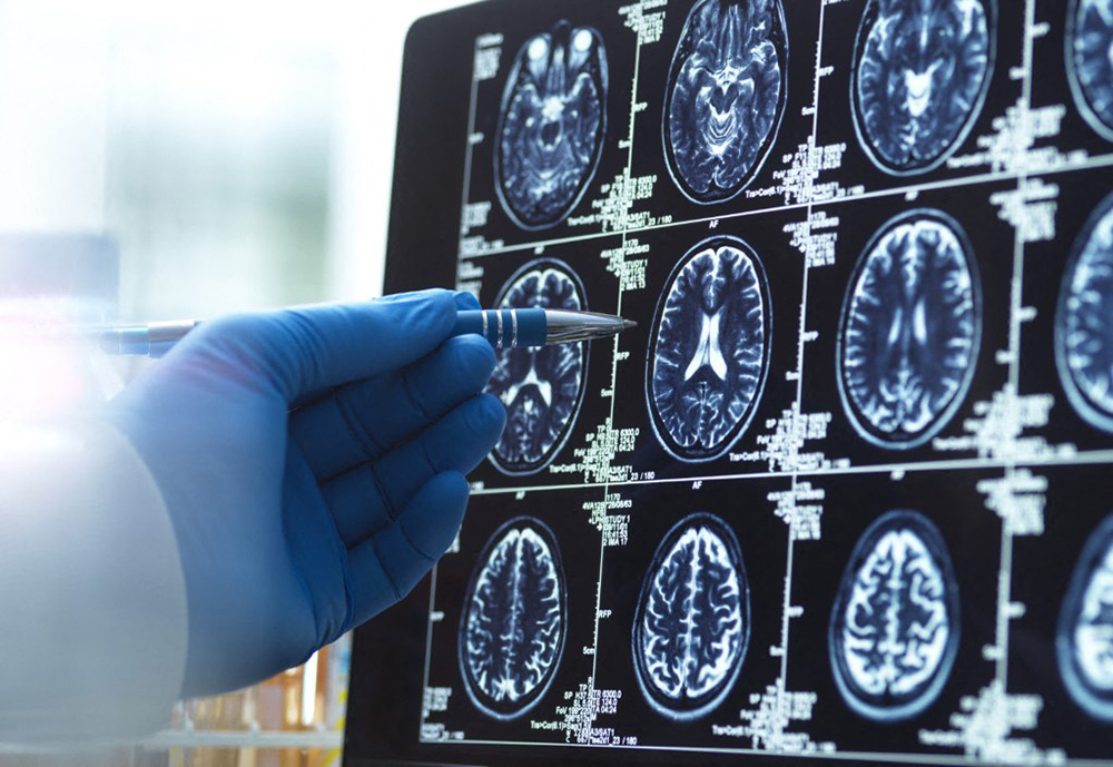 Doctor viewing a brain scan for possible ageing and disease (Photo by Andrew Brookes / Connect Images via AFP)