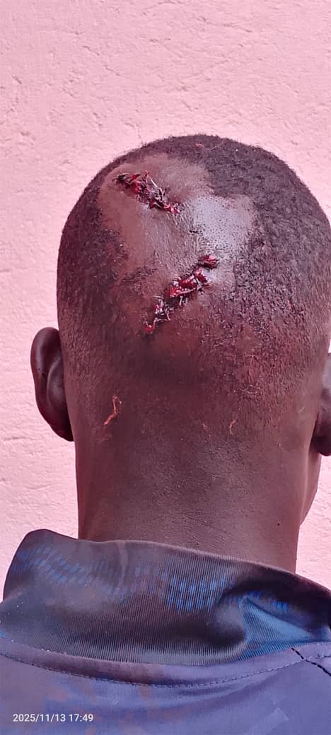 Omu ku baakubiddwa ng'alaga ebiwundu