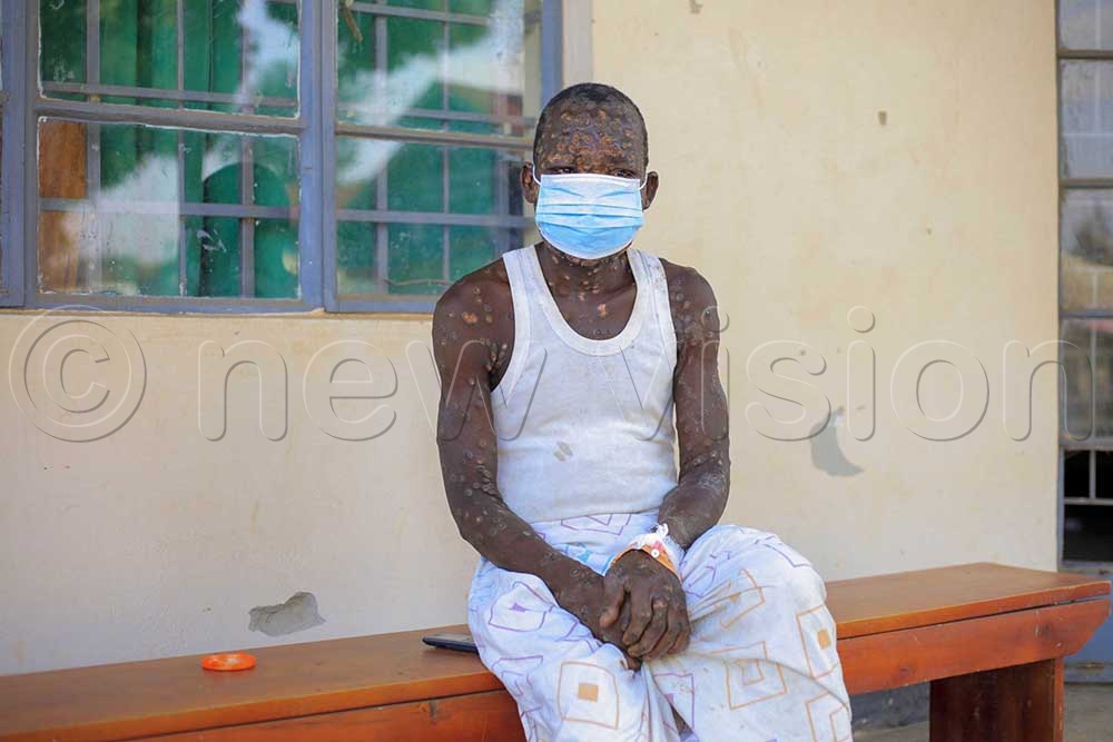 Mpox patient at Nakasongola district Isolation center. (Credit: John Musenze)