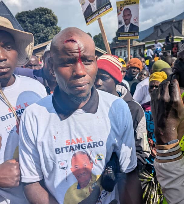 A supporter of former Member of Parliament (MP) Sam Bitangaro, who was injured on the forehead. (Courtesy photo)