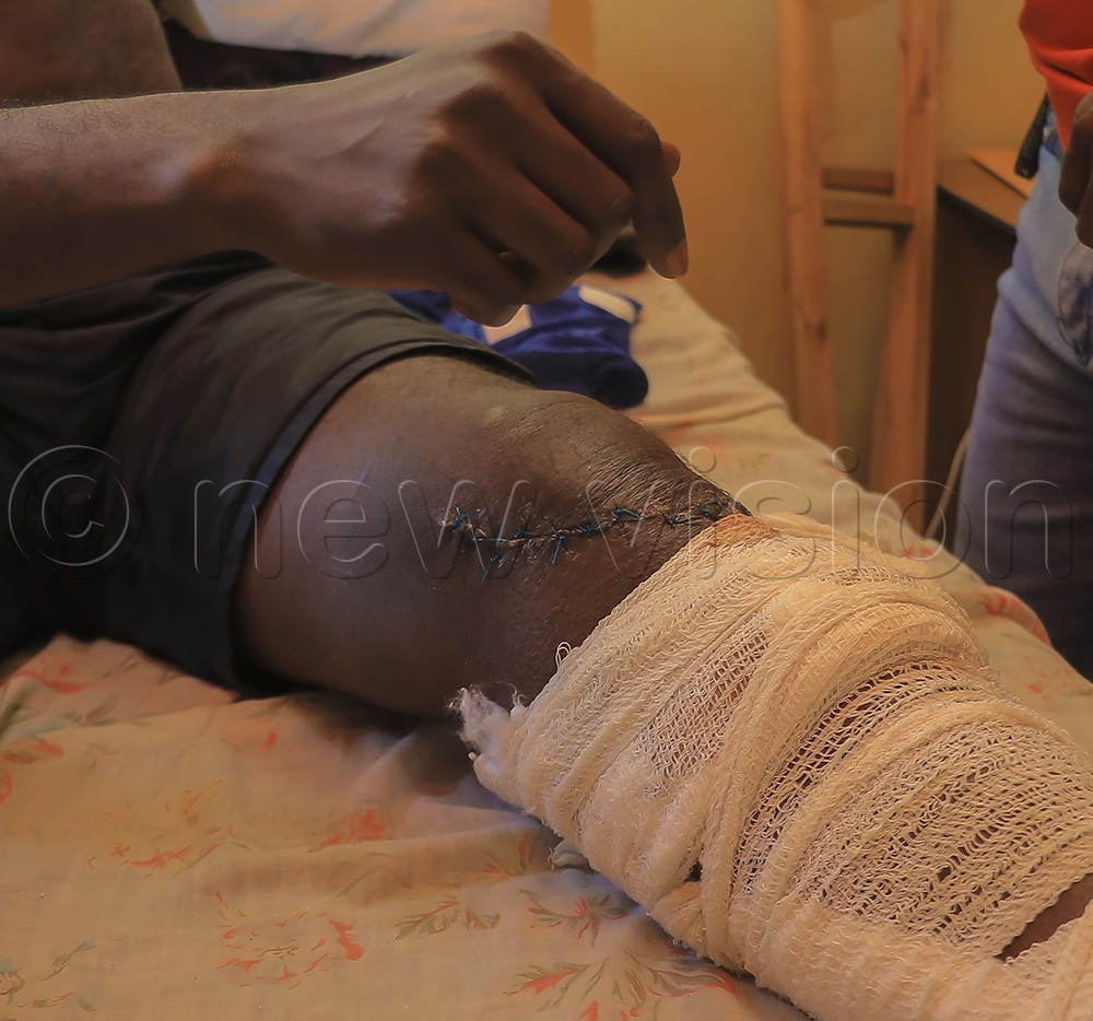 Some of the road crash victims still under under the care of Mulago Hospital.