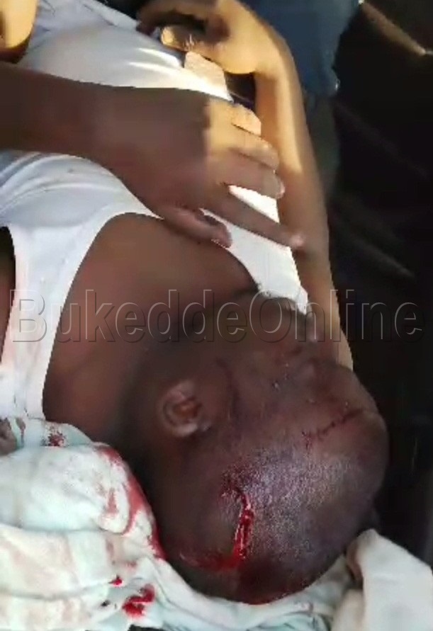 Omutuuze eyakoleddwako obulumbaganyi ng'ali ku kitanda apooca n'ebiwundu
