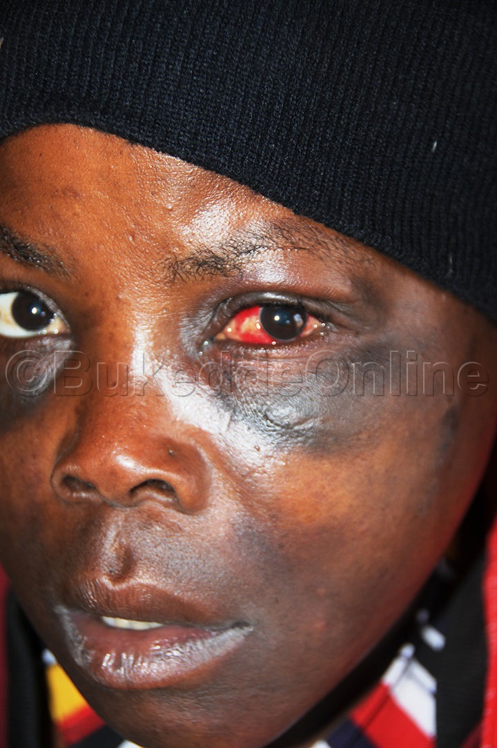 Naiga Alumiriza Naboti Okumukaka Akaboozi.