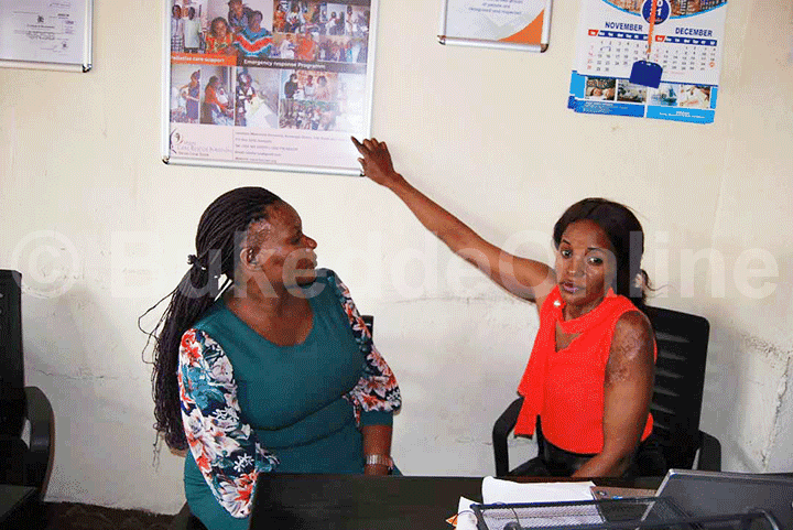  Kirungi ng'alaga abamu ku bantu abaayokebwa asidi 