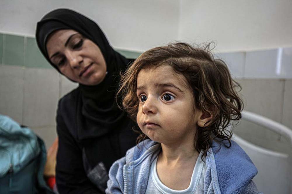 Palestinian child Jihad Saad is pictured at the Al-Rantisi Children's Hospital in Gaza City, May 4, 2025. (Photo by Xinhua)