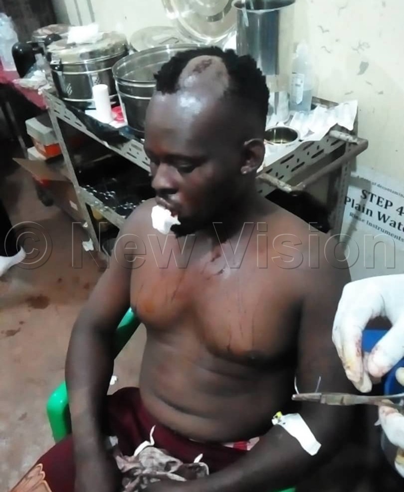 One of the injured who was admitted at Jinja regional referral hospital for first aid. (Credit: Doreen Musingo)